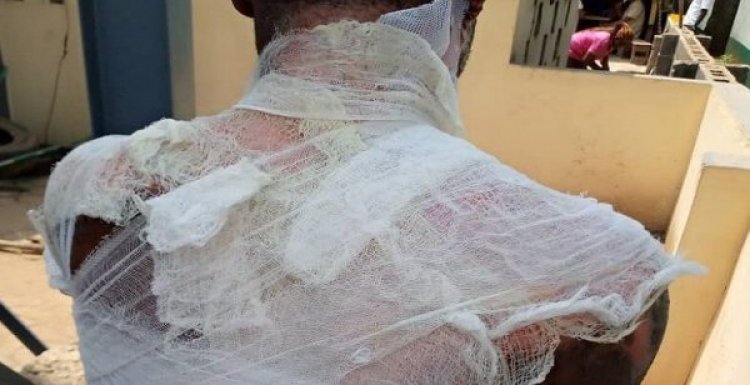 Nigeria: Umugore yicishije umugabo we amazi ashyushye ubwo yari asinziriye