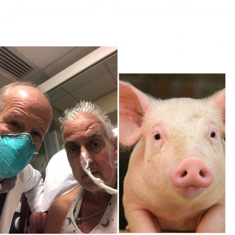 Wa mugabo bashyizemo umutima w’ingurube yitabye Imana