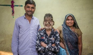 Yavutse bahita bamwogosha, uko Patidar yabaye nk'inguge