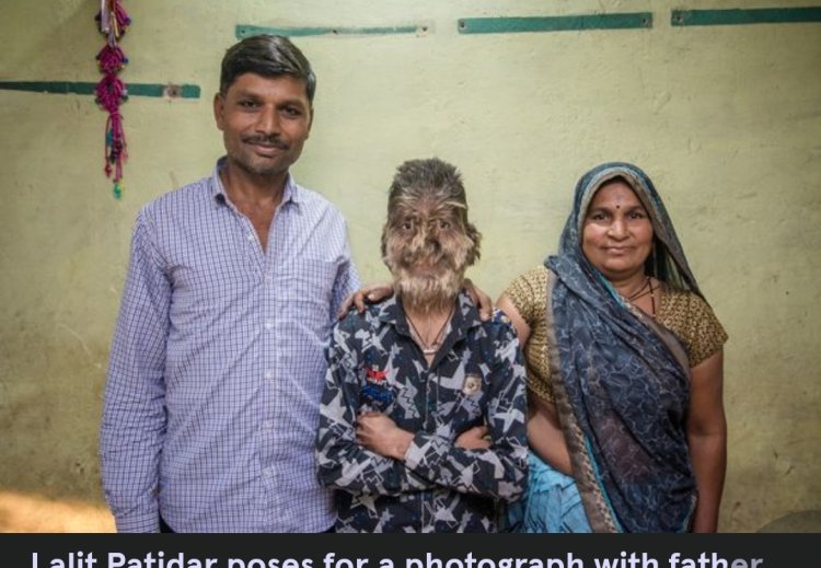 Yavutse bahita bamwogosha, uko Patidar yabaye nk'inguge