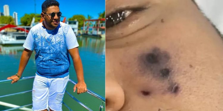 Igitagangurirwa cyivuganye umuhanzi muri Brazil