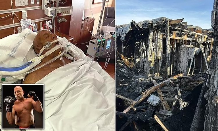 Rurangiranwa mu gutera amakofe ni indembe mu bitaro kubera imbwa