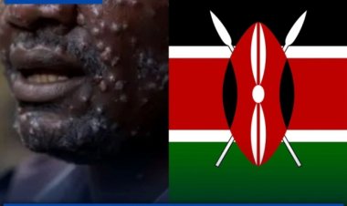 Muri Kenya umuntu wambere yasanganwe Virusi ya Mpox