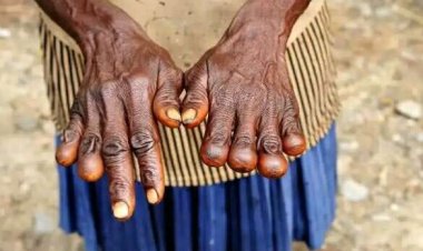 Papua New Guinea: Abagore bica intoki nk'ikimenyetso cy'agahinda ko gupfusha abagabo