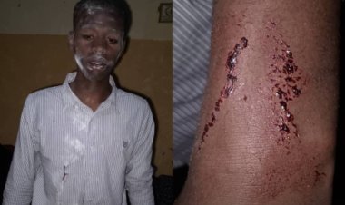 Umunyeshuri wa Kaminuza afungiwe kubeshya ko yashimuswe agasaba ibihumbi 100Rwf