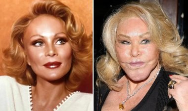 Umugore wahebye ubwiza bwe ngo ase n'injangwe yitabye Imana