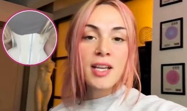 Kugira imiterere myiza byatumye yikuramo imbavu zose